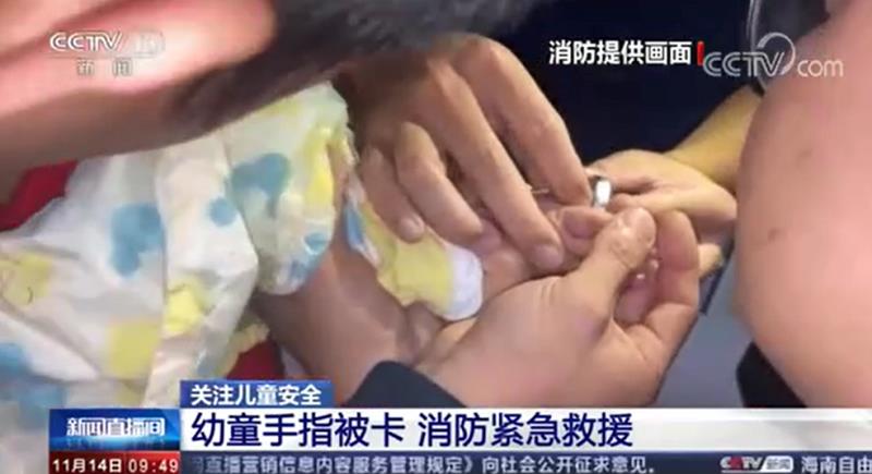 [新聞直播間]幼童手指被卡?消防緊急救援